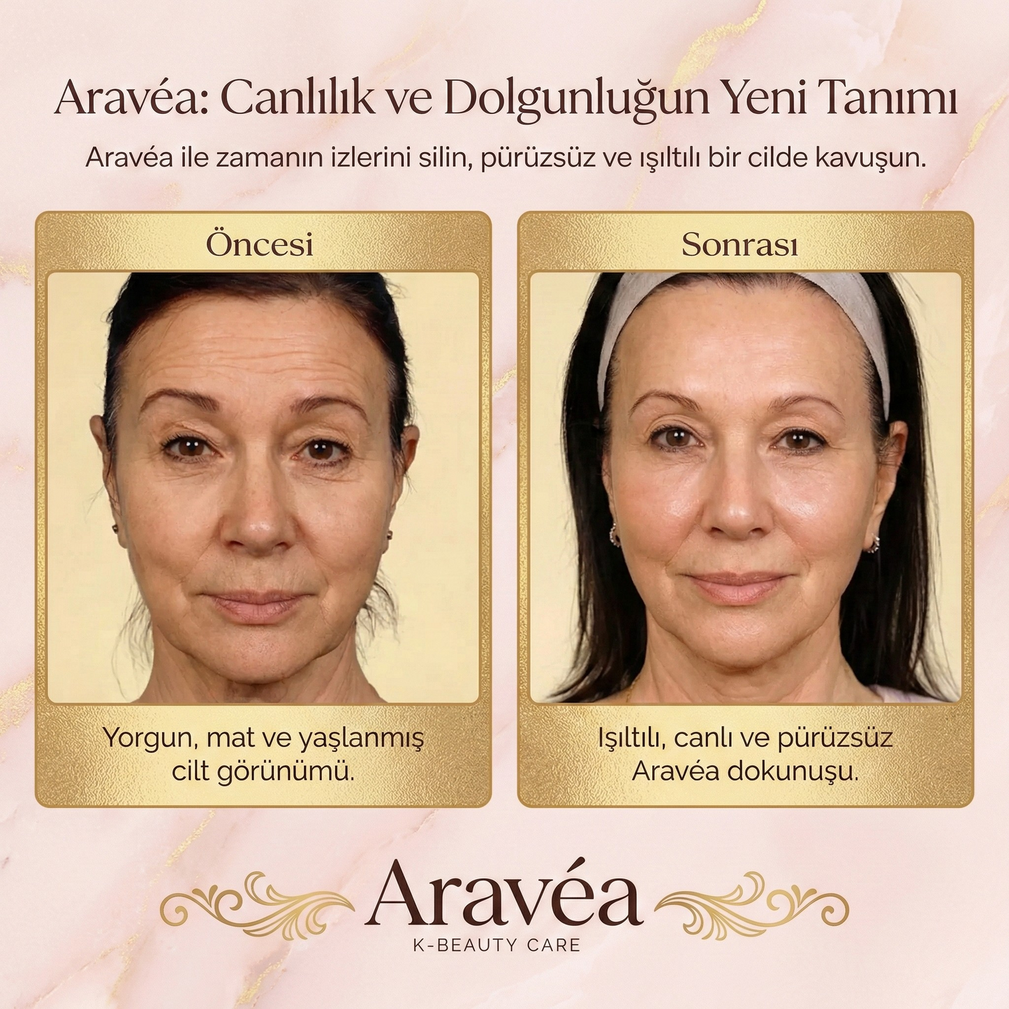 Aydınlatıcı Anti Aging Altın Capsule Cream